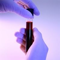 анализ крови антитела к тпо повышены