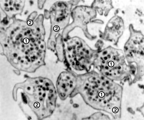Рис. 6а). Микрофотография тромбоцитов: при электронной микроскопии (1 — грануломер тромбоцита с гранулами различной формы; 2 — гиаломер тромбоцита, ×8000)