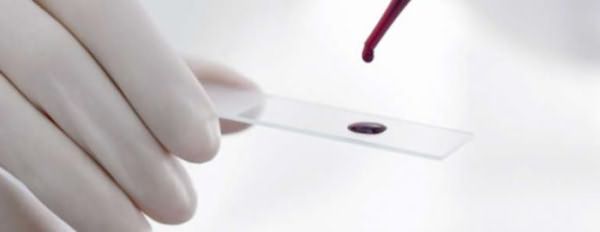 биохимический анализ крови расшифровка алт аст