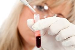 как определить группу крови ребенка по группе крови родителей