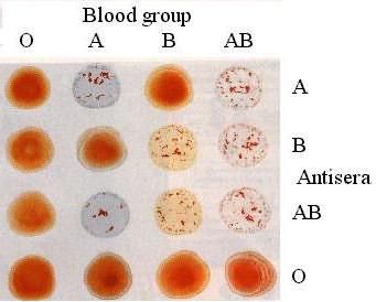 методы определения группы крови