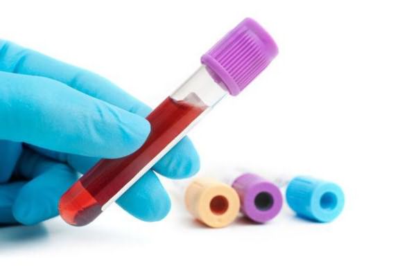 клинический анализ крови расшифровка mcv 