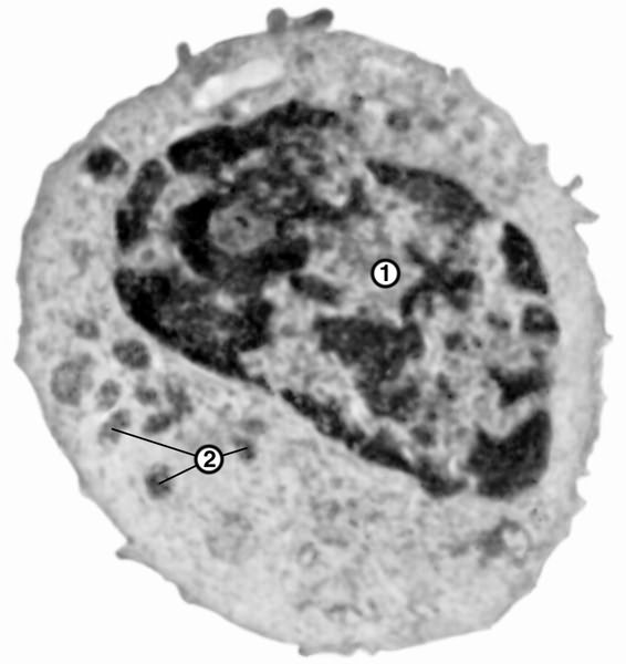 Рис. 4. Электронограмма малого лимфоцита: 1 — ядро с конгломератами хроматина; 2 — митохондрии; ×15 000