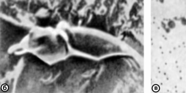 Рис. 6б,в). Микрофотографии тромбоцитов: б — при сканирующей электронной микроскопии (тромбоцит с различными отростками, ×8000); в — при световой микроскопии (тромбоциты разных размеров, ×900)