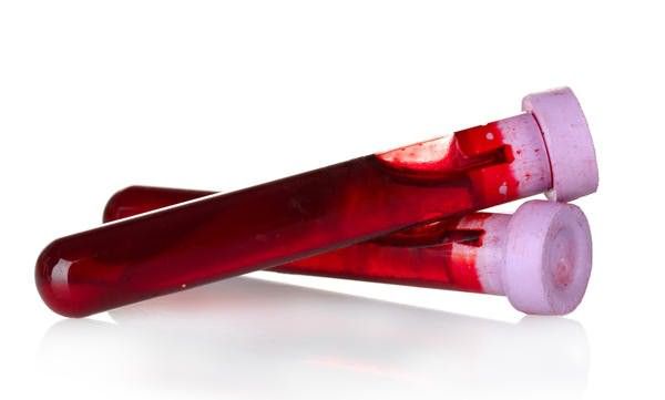 Анализ крови: лимфоциты повышены