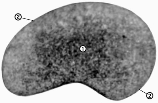 Рис. 1а). Микрофотография эритроцитов: при электронной микроскопии (1 — нежная грануляция, идентифицируемая с гемоглобином; 2 — наружная мембрана эритроцита, имеющая вид полоски на периферии клетки; ×13 8000)