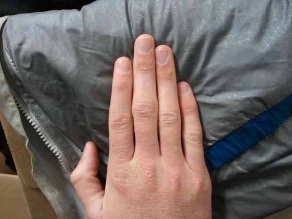 немеет средний палец правой руки